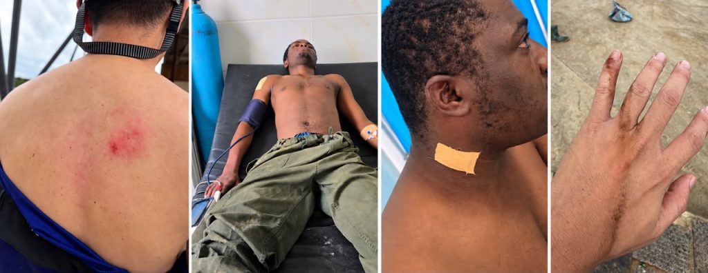Talensi: 3 persons injured in deep underground chaos in Gbane
